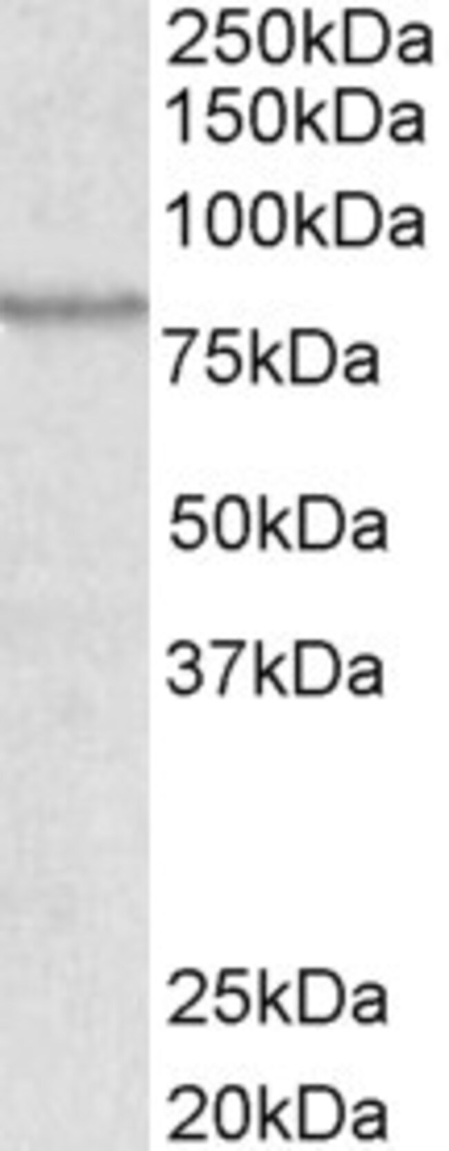 ABCB5 Polyclonal Antibody 100 µg µG