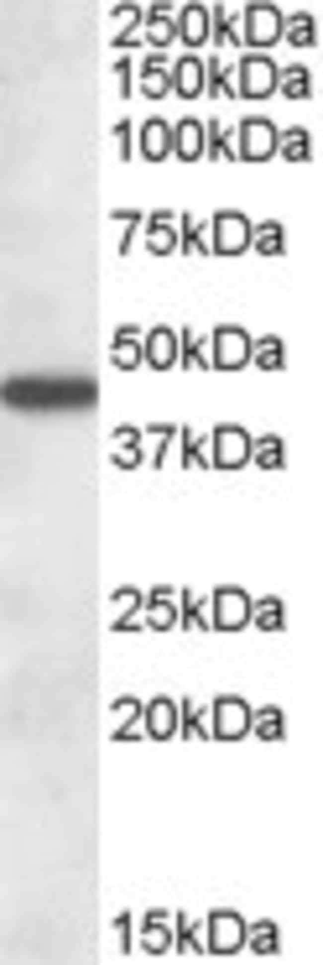 AADAT Polyclonal Antibody 100 µg µG