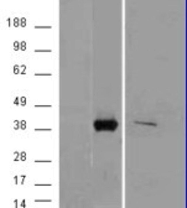 AKR1B10 Polyclonal Antibody 100 µg