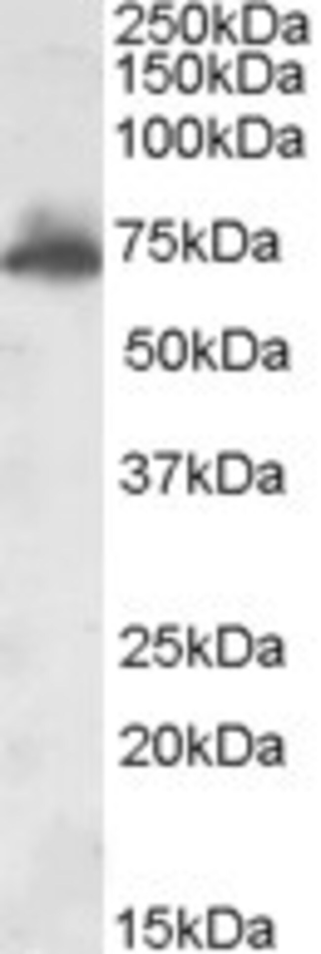 AKAP10 Polyclonal Antibody 100 µg µG