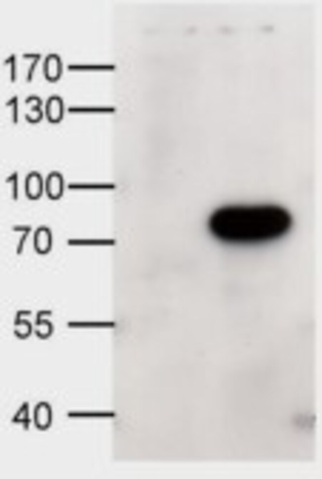 ABCD1 Polyclonal Antibody 100 µg µG