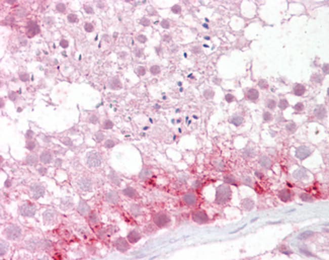 ABCD3 Polyclonal Antibody 100 µg µG