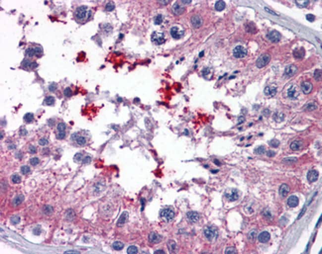 ABCD4 Polyclonal Antibody 100 µg µG
