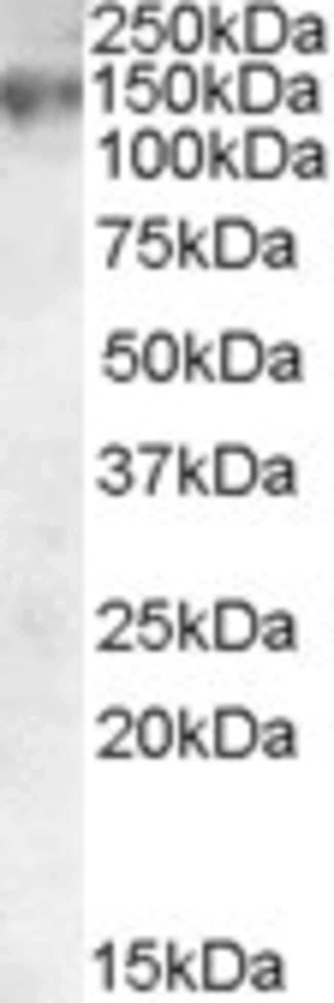 ABCC1 Polyclonal Antibody 100 µg µG