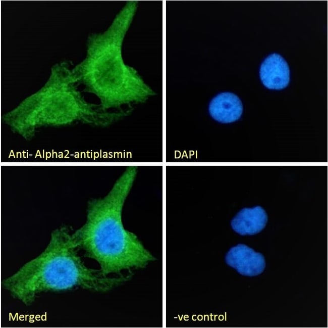 Alpha2-antiplasmin Polyclonal  Antibody
