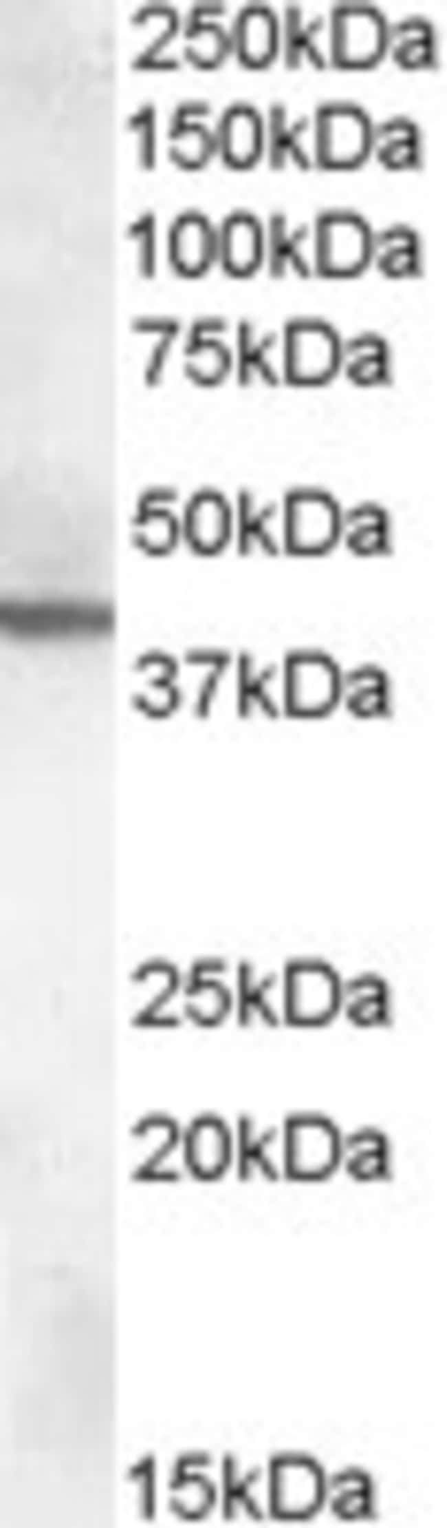 ABHD12 Polyclonal Antibody 100 µg µG