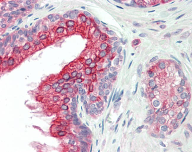 ANKK1 Polyclonal Antibody 100 µg µG