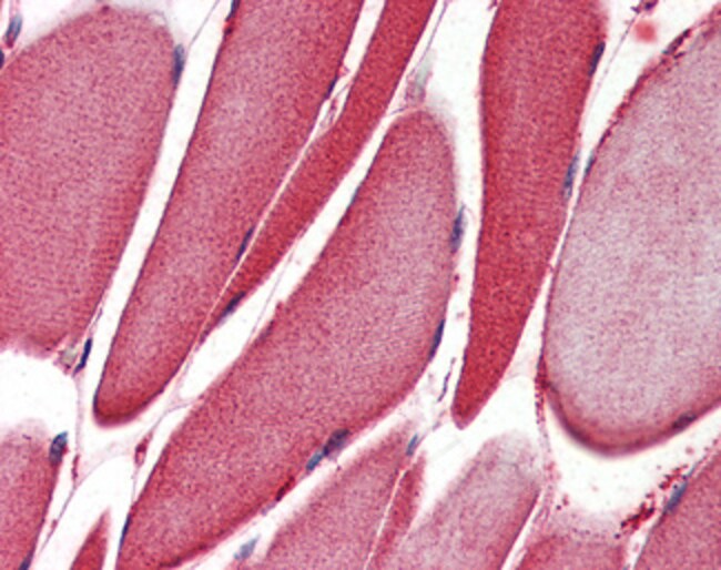 ALOX15 Polyclonal Antibody 100 µg µG