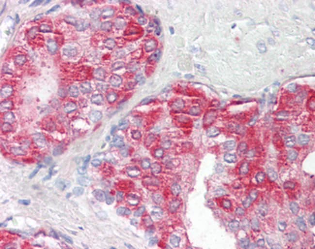 ACPP Polyclonal Antibody 100 µg µG