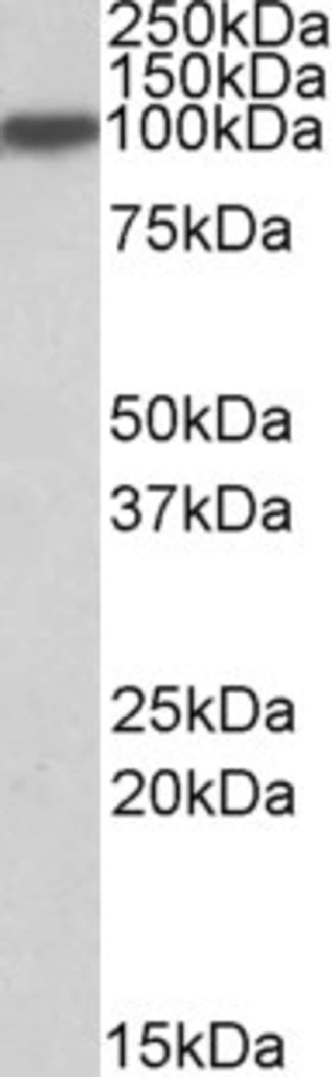 ACO1/Aconitase 1 Polyclonal Antib. 100 µ