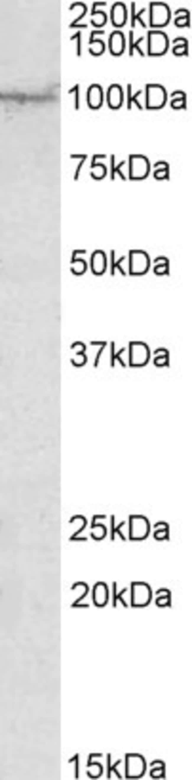 AAK1 Polyclonal Antibody 100 µg µG