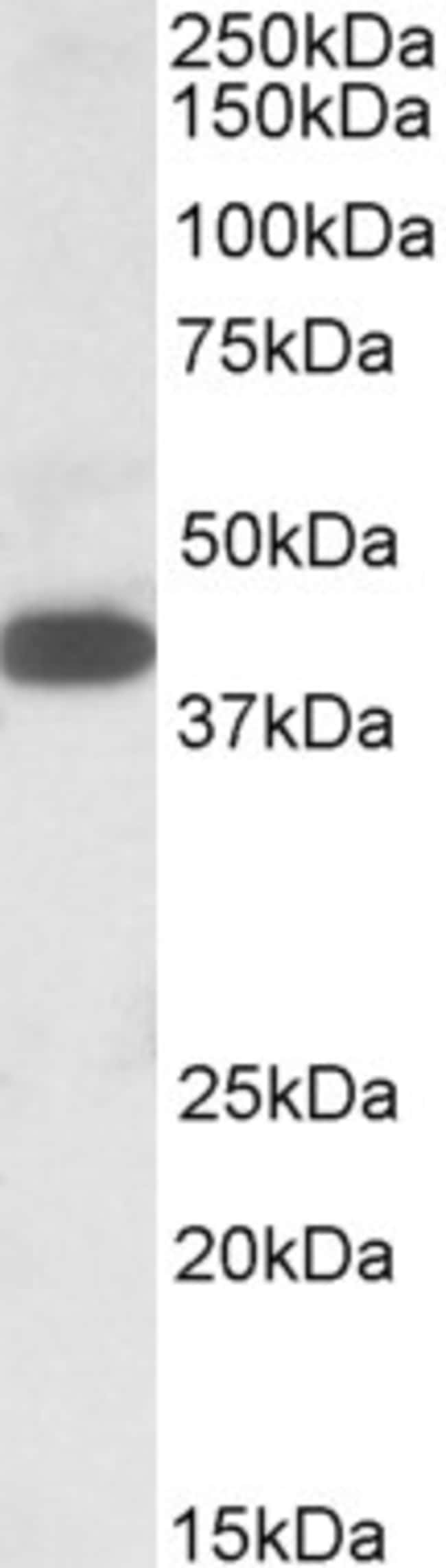 A4GNT/alpha4GNT Polyclonal Antibody 100