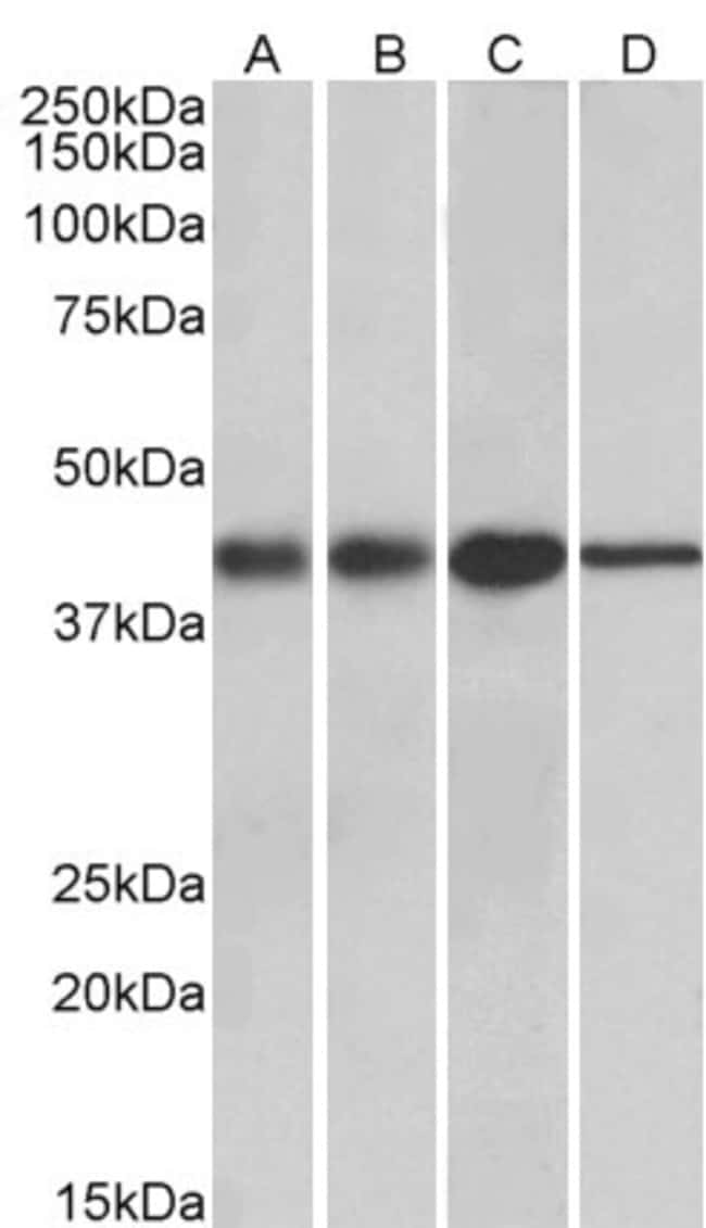 ACAT1 Polyclonal Antibody 100 µg µG