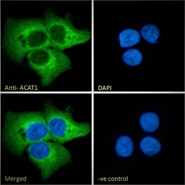 ACAT1 Polyclonal Antibody 100 µg µG