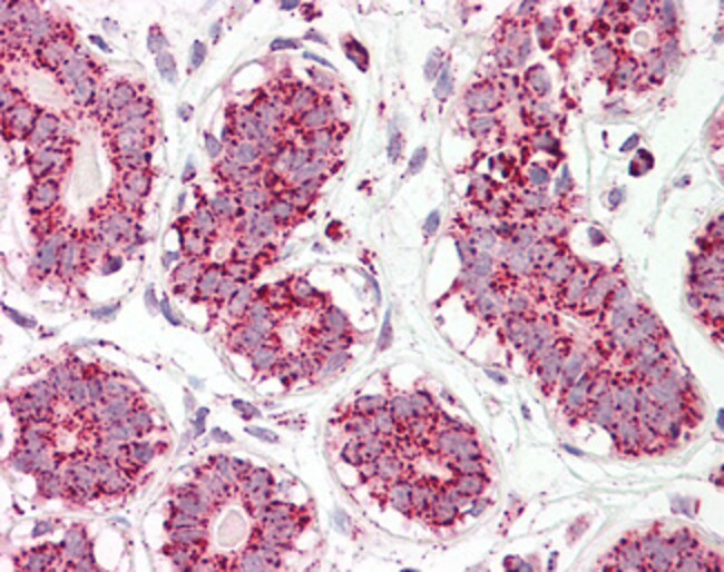 Aconitase 2 Polyclonal Antibody 100 µg 1