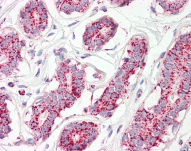 Aconitase 2 Polyclonal Antibody 100 µg