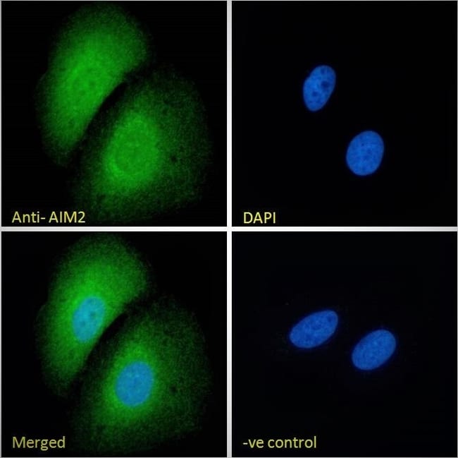 AIM2 Polyclonal Antibody 100 µg µG