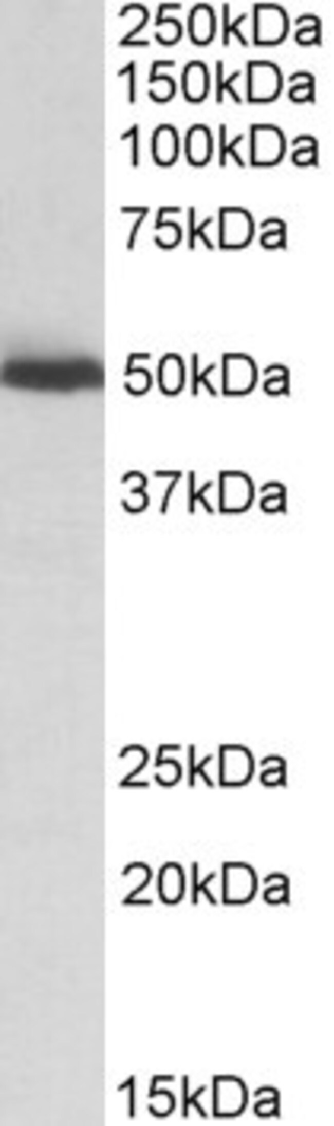 ALDH2 Polyclonal Antibody 100 µg µG