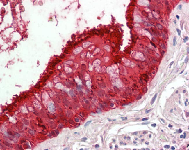 ALDH3A1 Polyclonal Antibody 100 µg