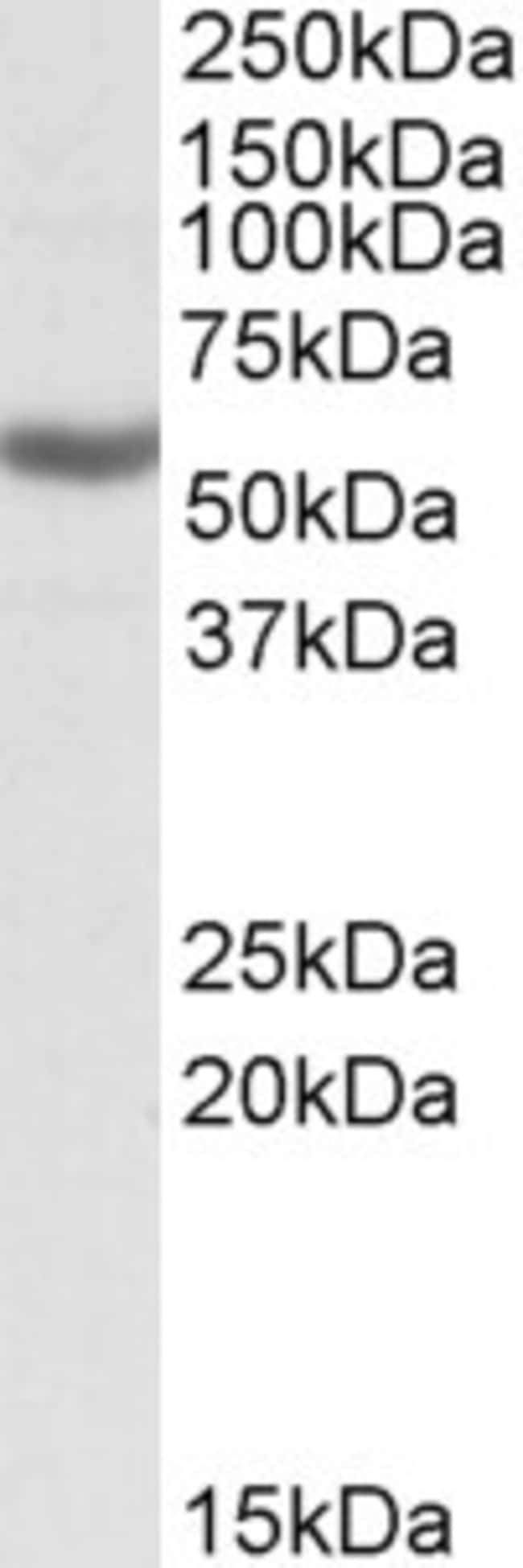 ALDH3B1 Polyclonal Antibody 100 µg