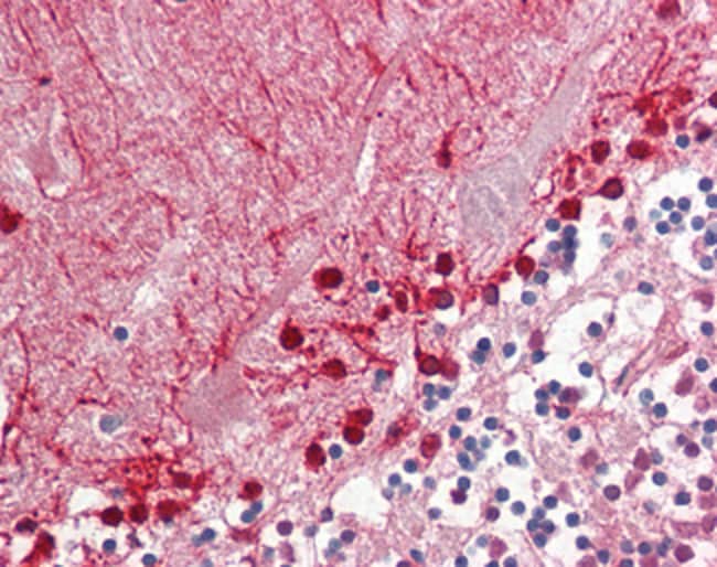 ALDH9A1 Polyclonal Antibody 100 µg