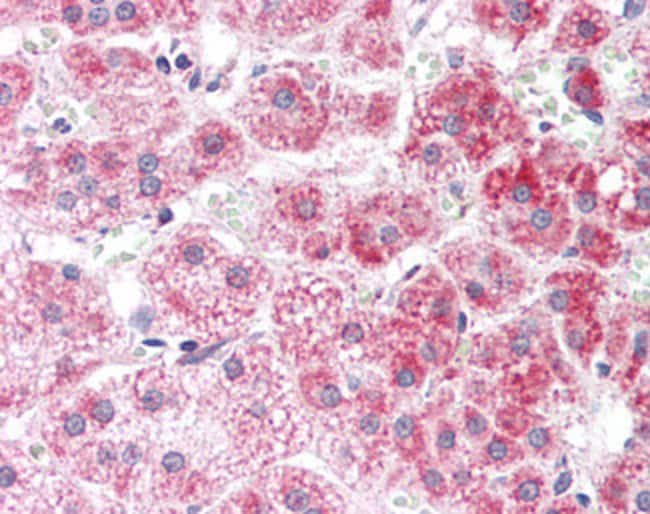 ALDH3A2 Polyclonal Antibody 100 µg