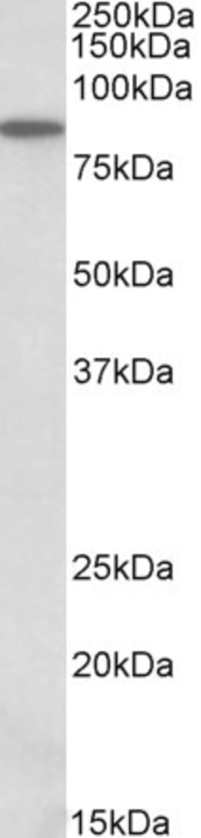 ALDH18A1 Polyclonal Antibody 100 µg
