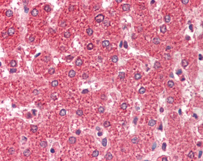 ALDH5A1 Polyclonal Antibody 100 µg