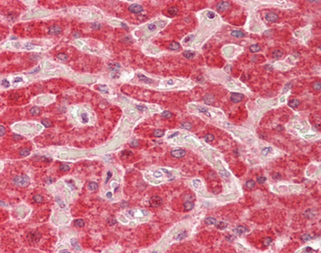 ALDH5A1 Polyclonal Antibody 100 µg