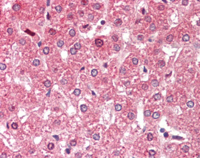 ALDH6A1 Polyclonal Antibody 100 µg