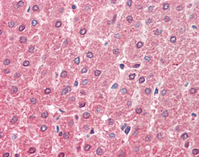 ALDH6A1 Polyclonal Antibody 100 µg