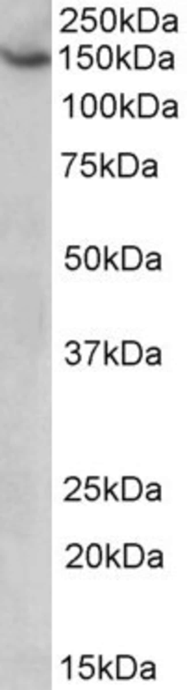 AGTPBP1/NNA1 Polyclonal Antibody 100 µg