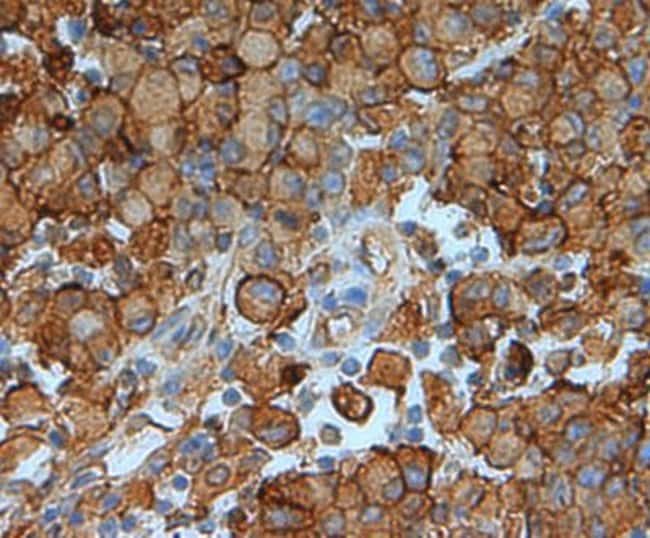 Annexin II polyclonal Antibody 100 µg