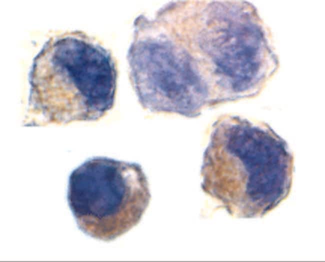 ADAM10 Polyclonal Antibody, 100 µg