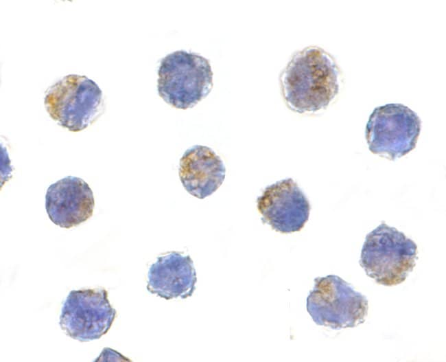 AIF Polyclonal Antibody, 100 µg