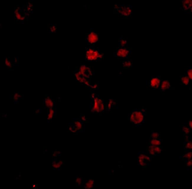 AATF Polyclonal Antibody, 100 µg