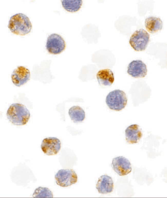 AID Polyclonal Antibody, 100 µg