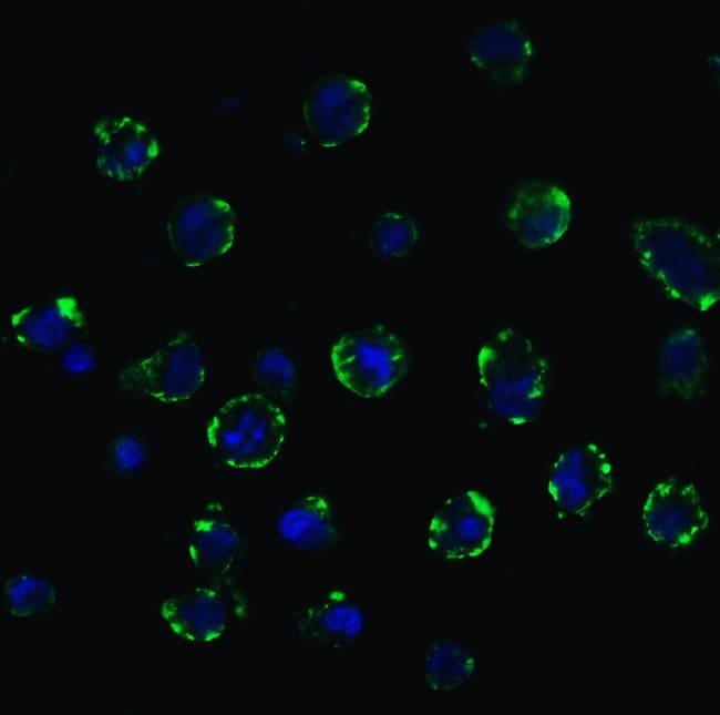 ACE2 Polyclonal Antibody, 100 µg