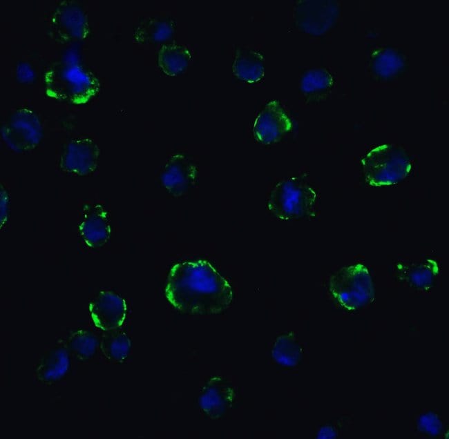 ACE2 Polyclonal Antibody, 100 µg