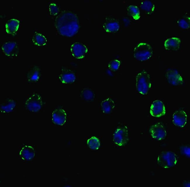 ACE2 Polyclonal Antibody, 100 µg