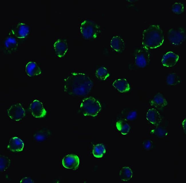 ACE2 Polyclonal Antibody, 100 µg