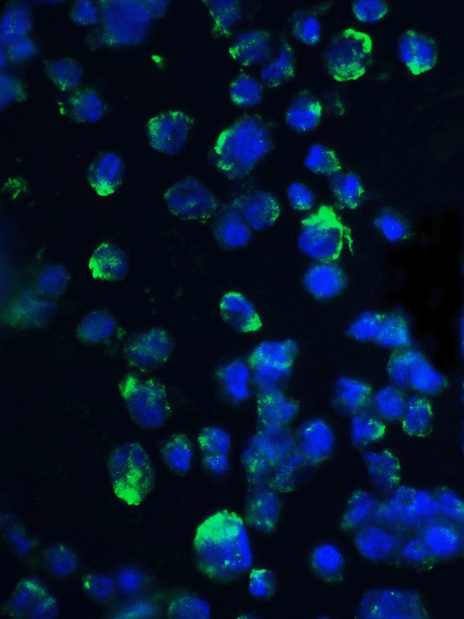 4E-BP1 Polyclonal Antibody, 100 µg