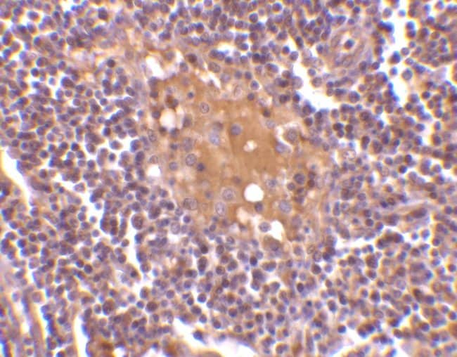 AIM Polyclonal Antibody, 100 µg
