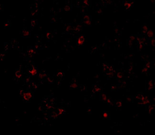 AIM Polyclonal Antibody, 100 µg