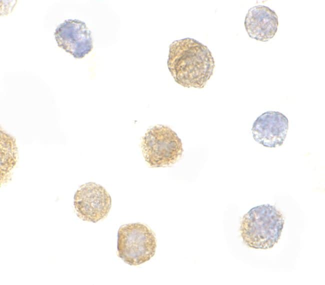 ADAP Polyclonal Antibody, 100 µg