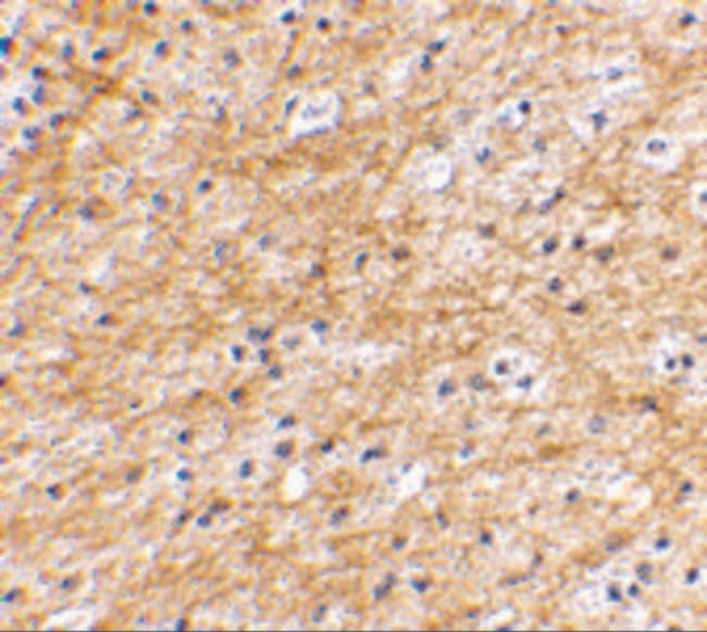 AIFM3 Polyclonal Antibody, 100 µg