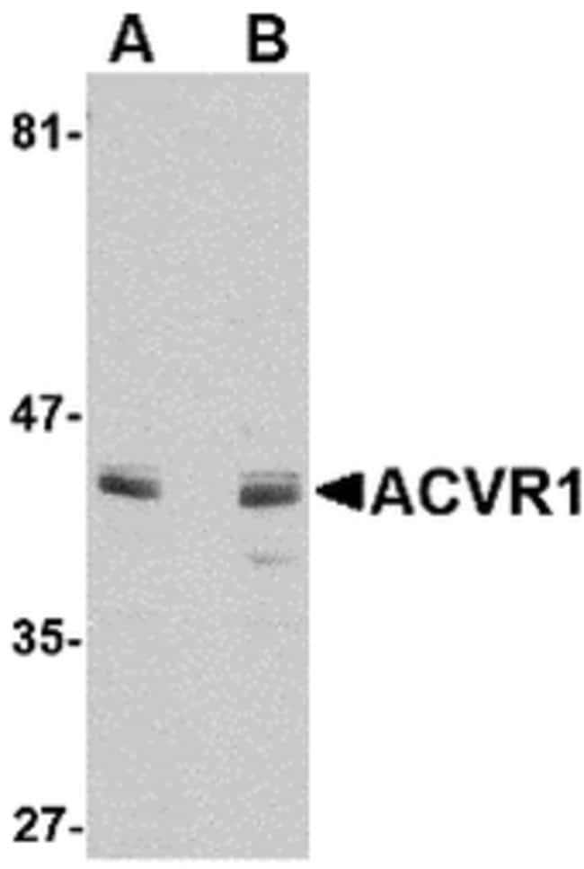 ACVR1 Polyclonal Antibody, 100 µg