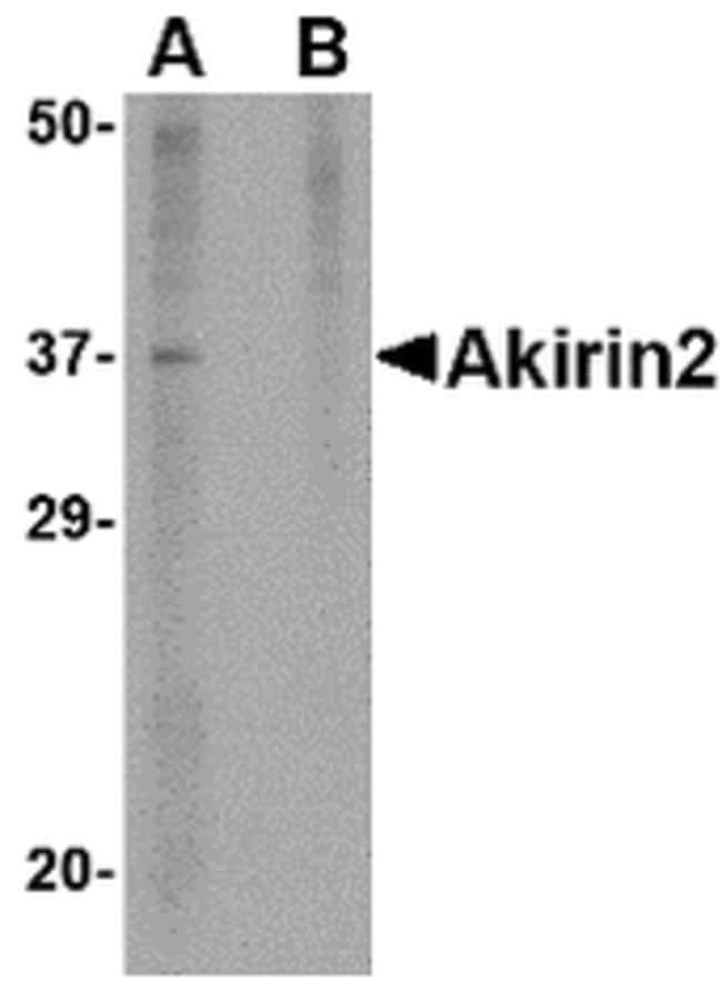 Akirin2 Polyclonal Antibody, 100 µg