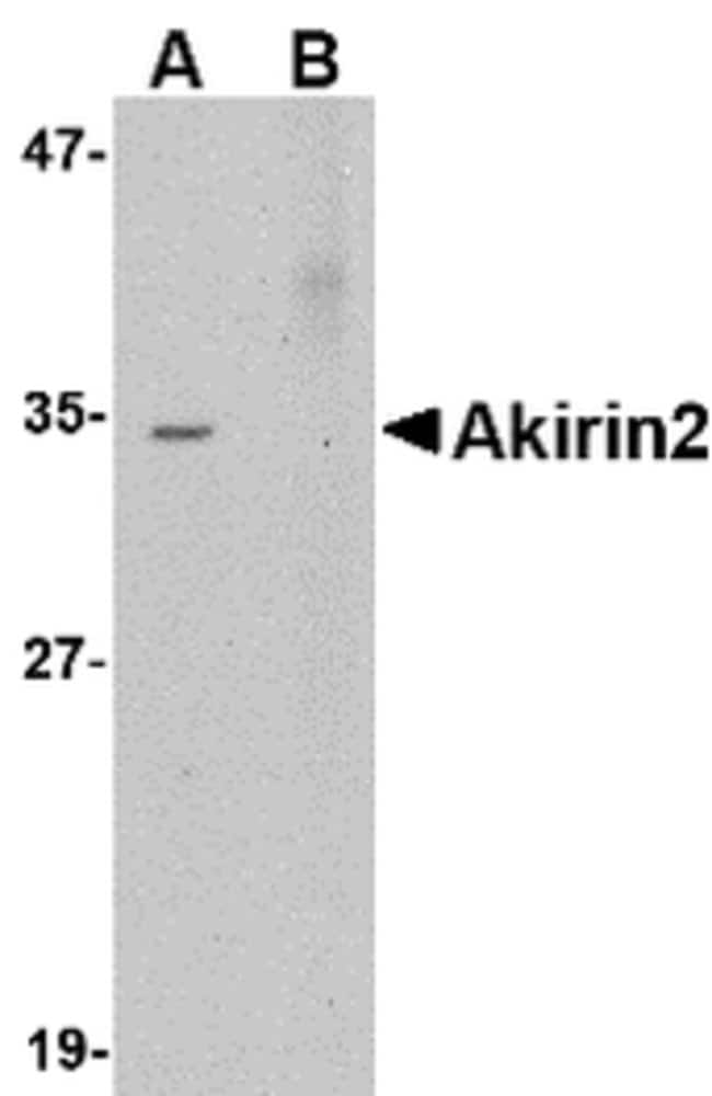 Akirin2 Polyclonal Antibody, 100 µg