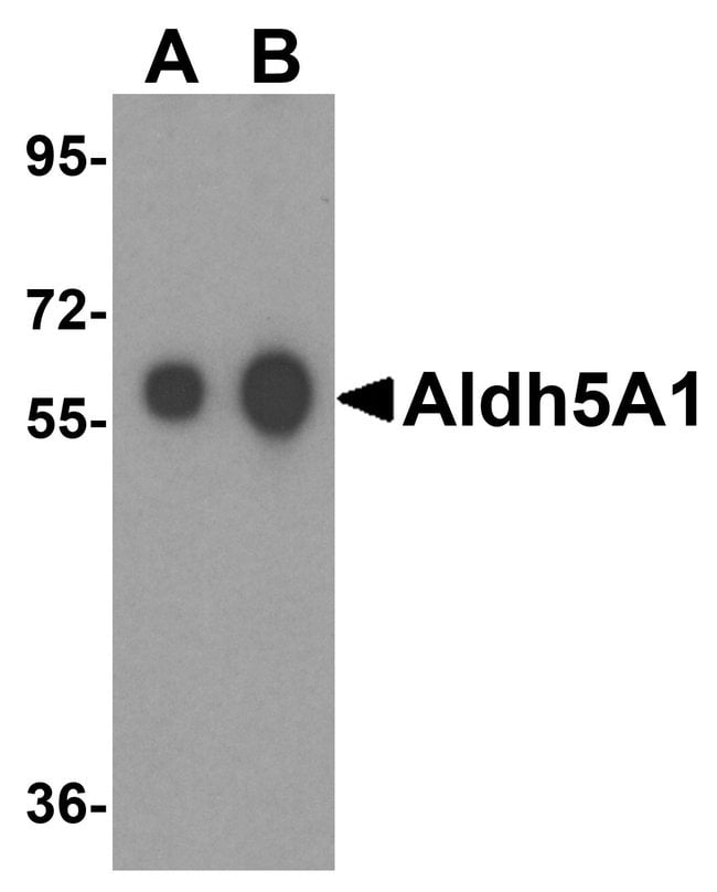 Aldh5A1 Polyclonal Antibody, 100 µg